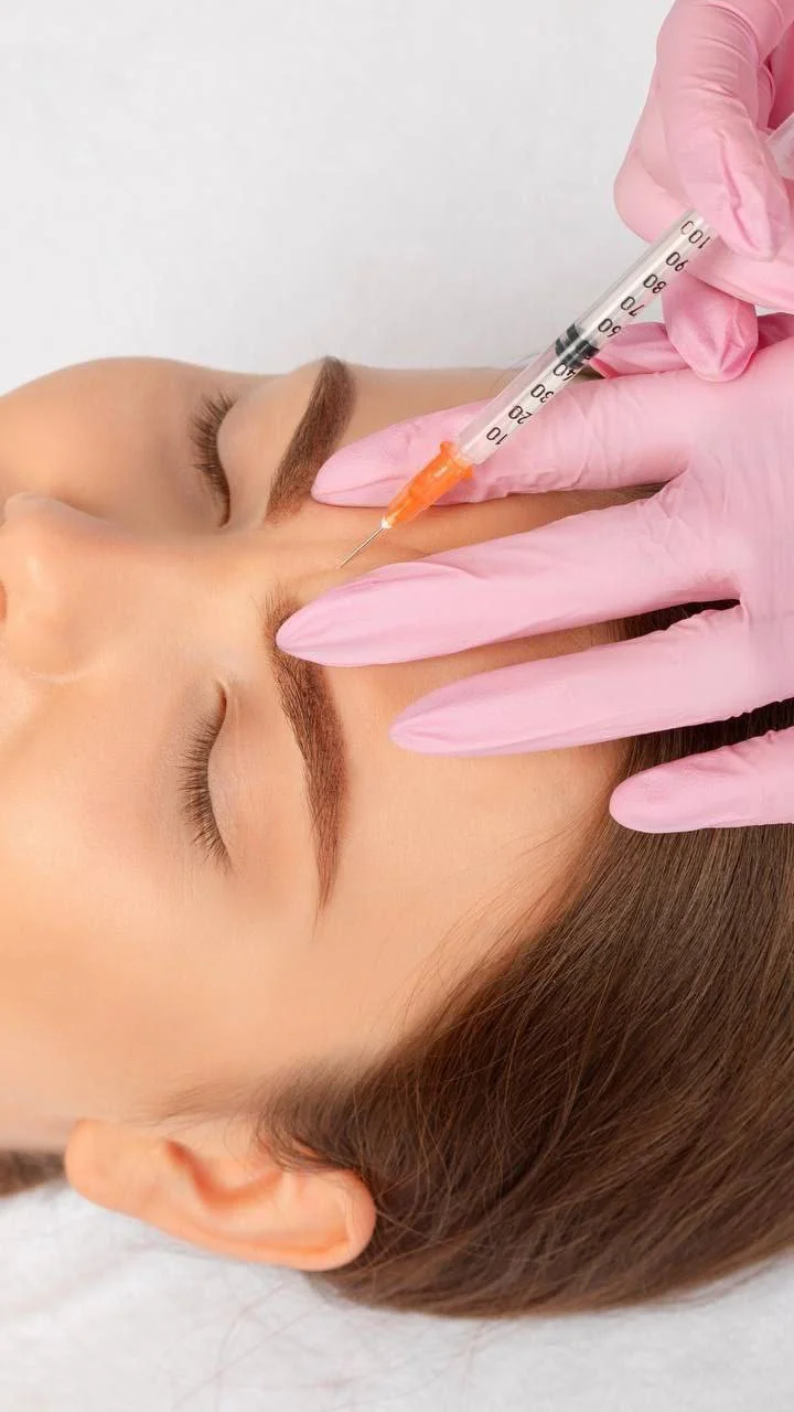 Ботулинотерапия